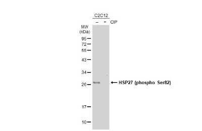 Western Blot: HSP27 [p Ser82] Antibody [NBP3-13297]